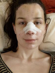 Aella Girl exclusive onlyfans leaked nudes